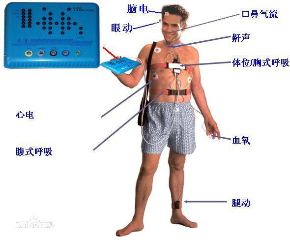 家庭智能健康检测设备的崛起及其深远影响